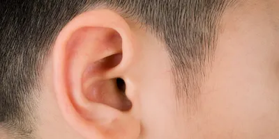 ear correction surgery for men, pinnaplasty, otoplasty for men