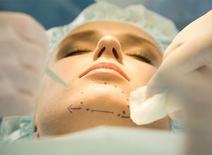 genioplasty and chin implant surgery for women