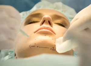 female patient being prepped for chin implant surgery, chin augmentation.