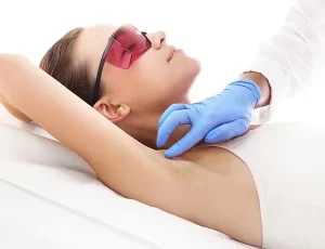 female client having laser hair removal appointment for underarm hair removal. 