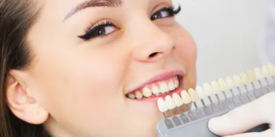 Young woman smiling and preparing for Phillips Zoom teeth whitening procedure