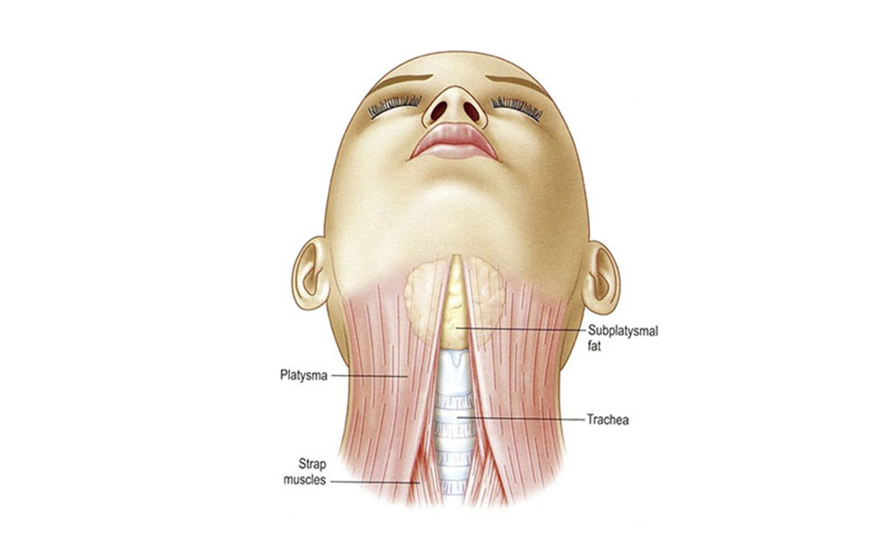 neck muscles diagram - platysma, strap muscles