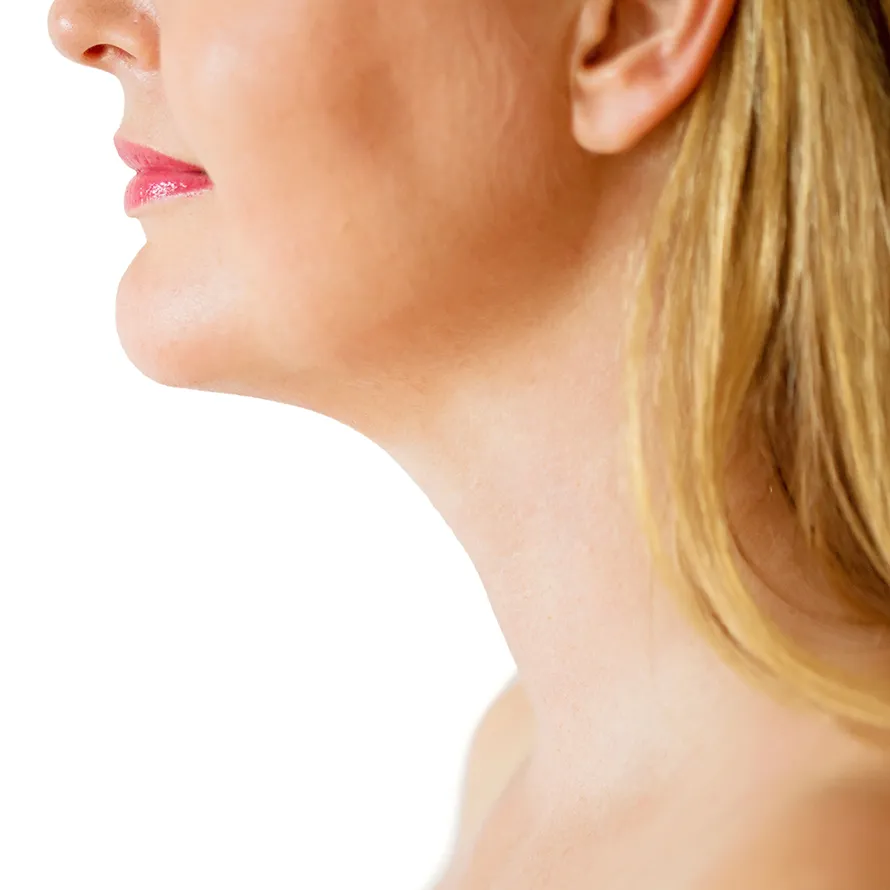 A woman who has had neck and chin surgery
