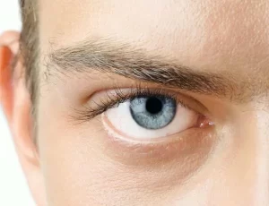 A man with refreshed looking eyes after recovering from men's upper eyelid surgery
