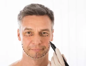 men's facelift surgery